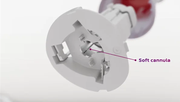 ein weißes Kabel, das in eine weiße Wand gesteckt ist