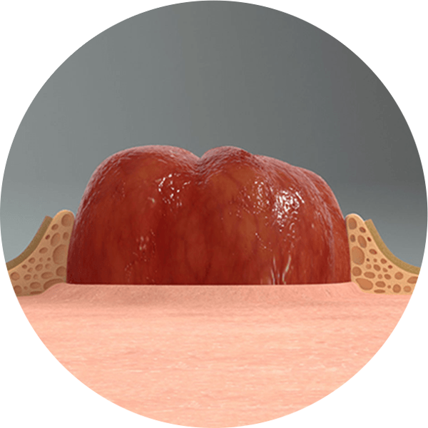 启用 LEAK-LOCK™ 技术